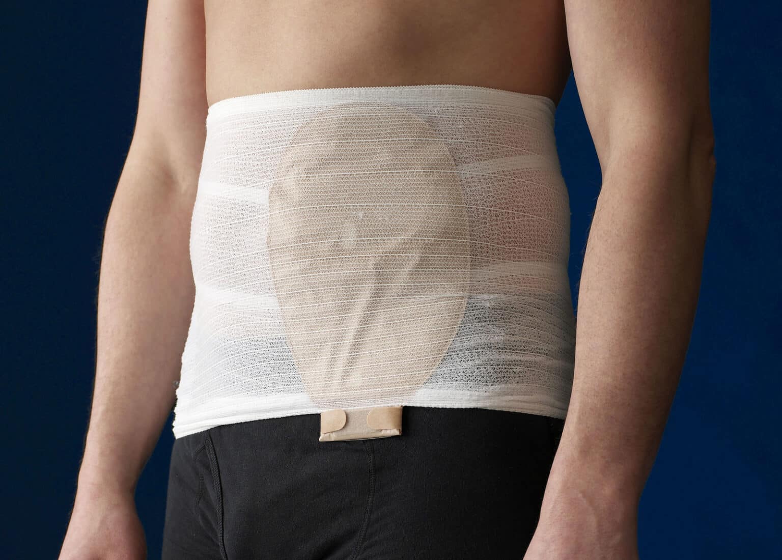 Kerge toega stoomivöö StomaSafe Classic meditex.ee